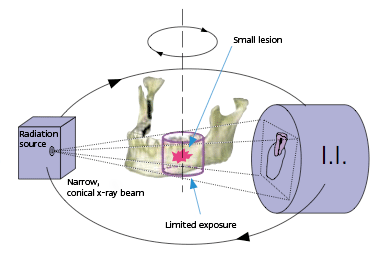 Ablauf der Radiographie