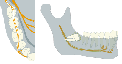 Anatomie Weisheitszahnregion